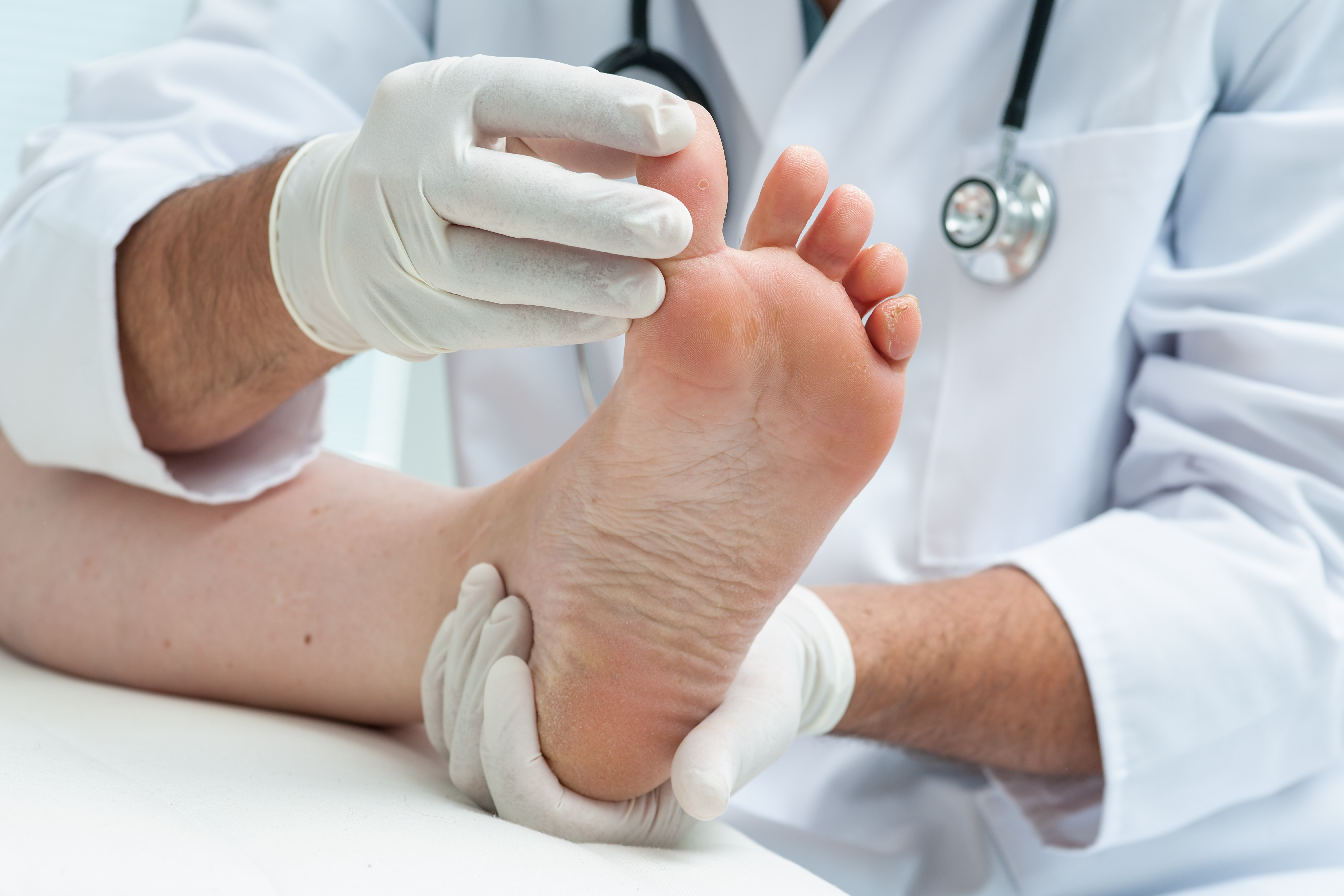 Image of foot being examined by a doctor wearing white exam gloves and a white lab coat.