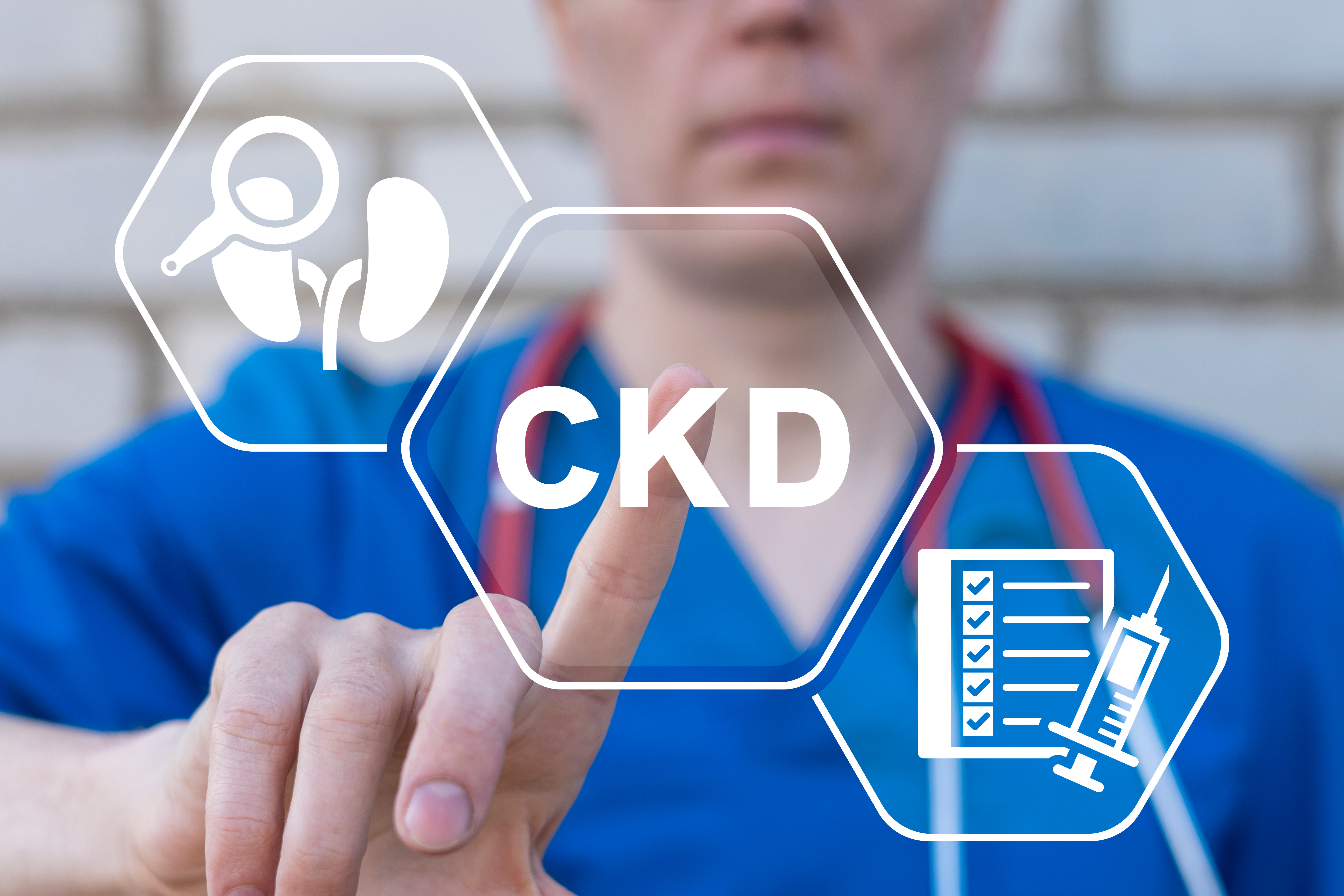 Doctor using virtual touchscreen presses abbreviation: CKD. Medical concept of CKD Chronic Kidney Disease.