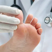 Clinician examining a foot